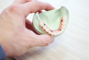 Rehabilitación oral