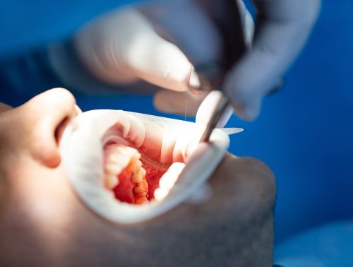 maxilofacial